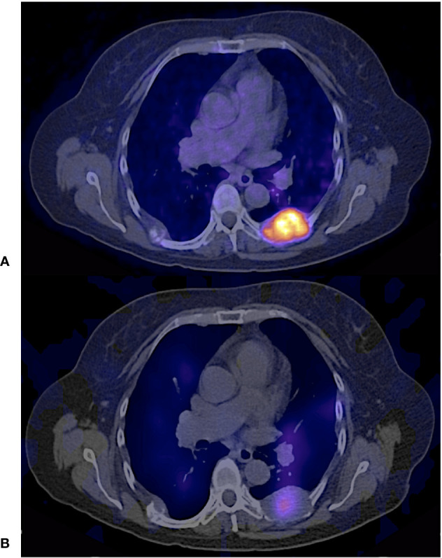 Figure 11