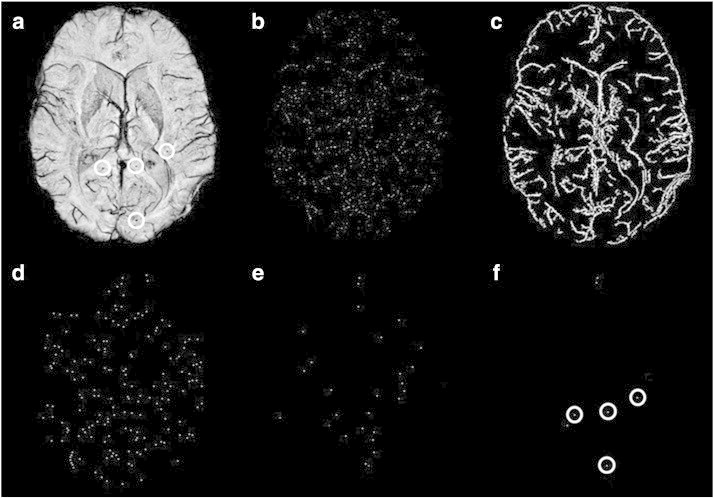 Fig. 2