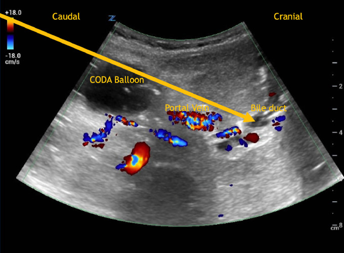 Fig 2-