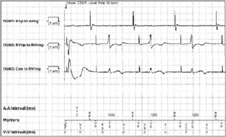 Figure 2