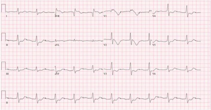 Figure 1