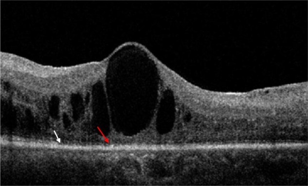 Figure 4