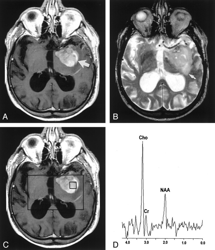 Fig 2.