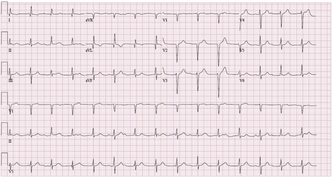 Figure 1