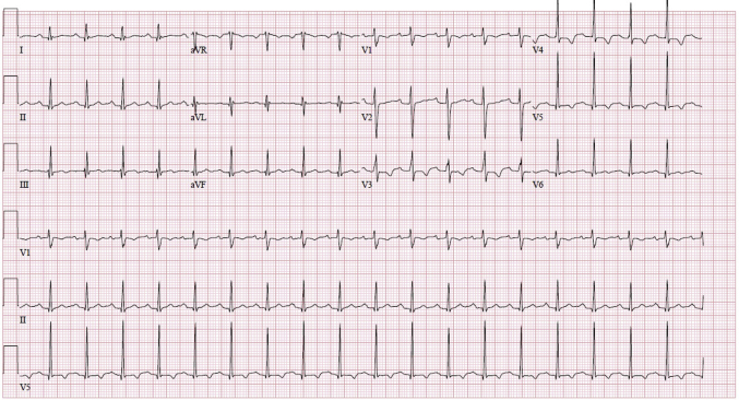 Figure 3