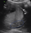 Fig. 5