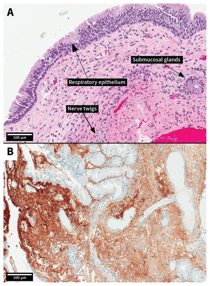 Figure 3: