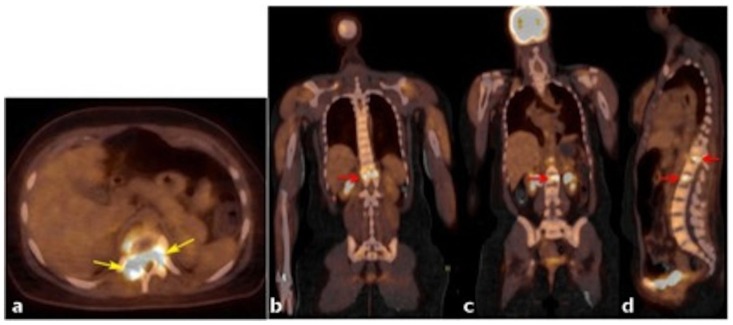 Figure 11