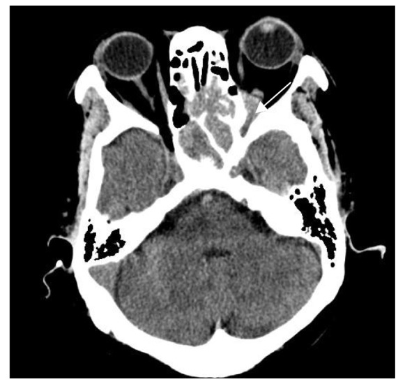 Figure 2.