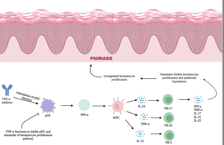 Paradoxical Tumor Necrosis Factor-Alpha (TNF-α) Inhibitor-Induced ...