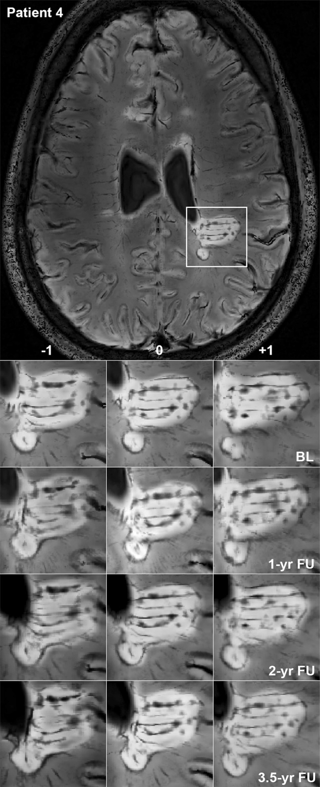 Fig. 6