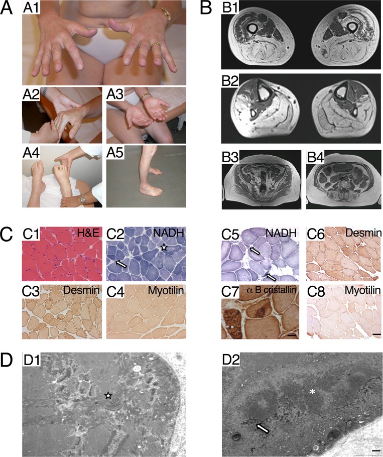 Fig 1