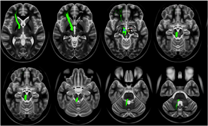 Fig. 2