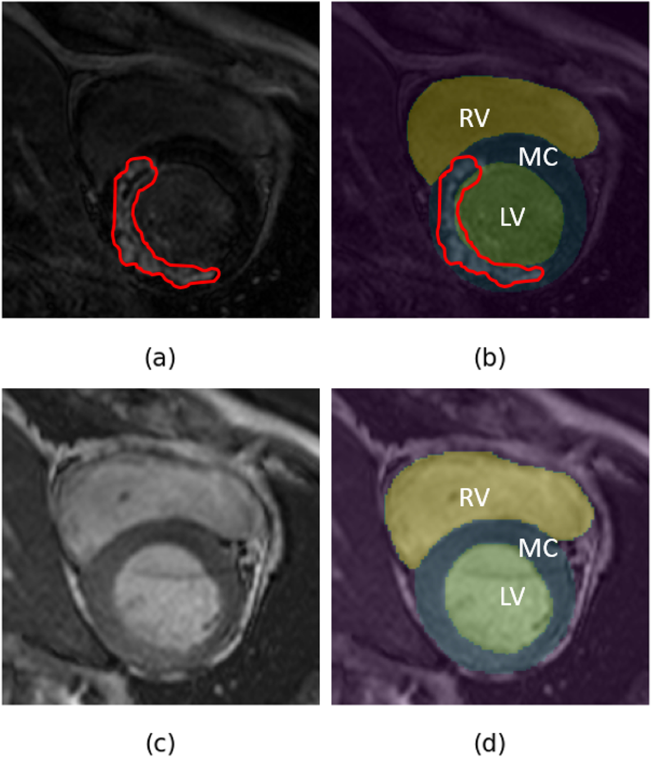 Figure 1: