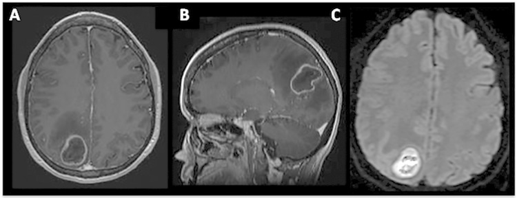 FIG 1