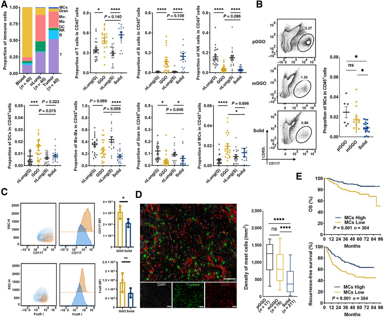 Figure 1. The accumulation and prognostic significance of LUAD-infiltrating MCs. A, Flow identification of LUAD immune cell composition (gating strategy shown in Supplementary Fig. S1A) and quantification as a proportion of CD45+ cells (n = 40 for peripheral blood, nLung, and LUAD). *, P < 0.05; ***, P < 0.001; ****, P < 0.0001; Mann–Whitney. B, Representative flow plots showing identification of MCs by FCM (left, additional replicates and full gating in Supplementary Fig. S1C), proportion of pGGO-, mGGO-, or sLUAD-infiltrating MCs in CD45+ cells (right). *, P < 0.05; Mann–Whitney. C, Representative CD117 and FcεRI expression of gMCs (SSClowCD117hiFcεRIhi; yellow) and sMCs (SSChiCD117lowFcεRIlow; blue). D, Two-plex staining panel showing the distribution of MCs (left) and MCs quantification as density (cell counts per mm2; right). ****, P < 0.0001; two-tailed unpaired t test. E, The prognostic value of MCs in surgically resected LUAD by mIF. P values were determined by log-rank test, and patients were stratified by median values. ns, nonsignificant.