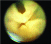 Fig. 3a