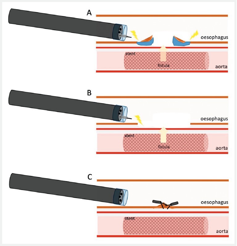 Fig. 2