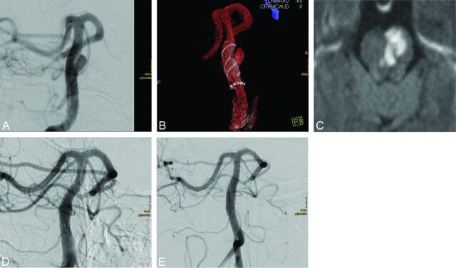 Fig 4.