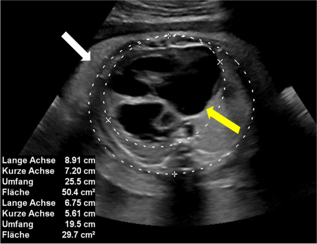 Fig. 2