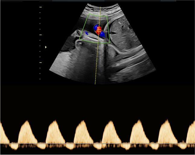 Fig. 5