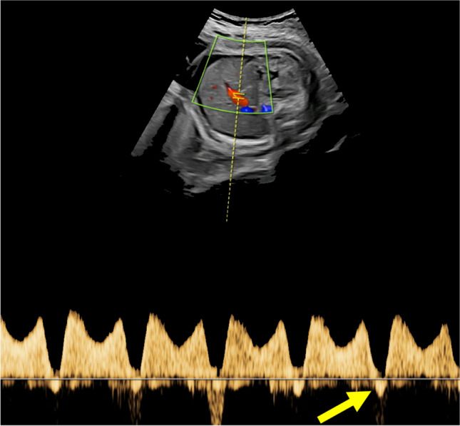 Fig. 7