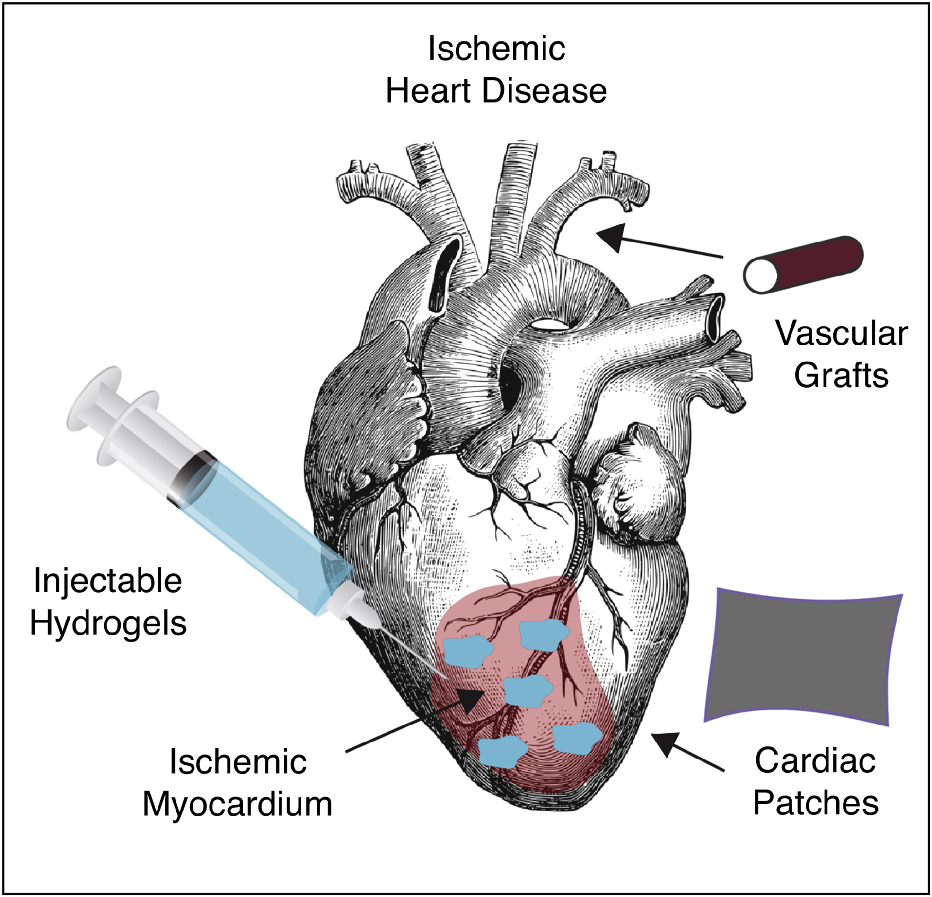 Figure 1: