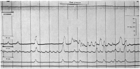 FIG. 5