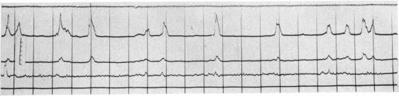 FIG. 8