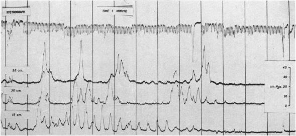 FIG. 9