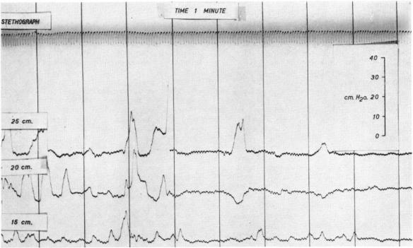 FIG. 11