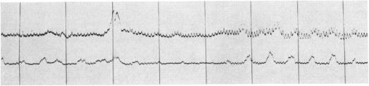 FIG. 13