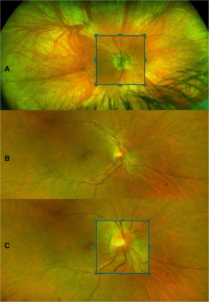 Fig. 3