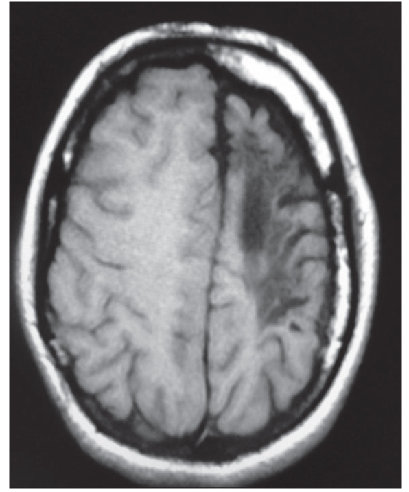 Figure 1C