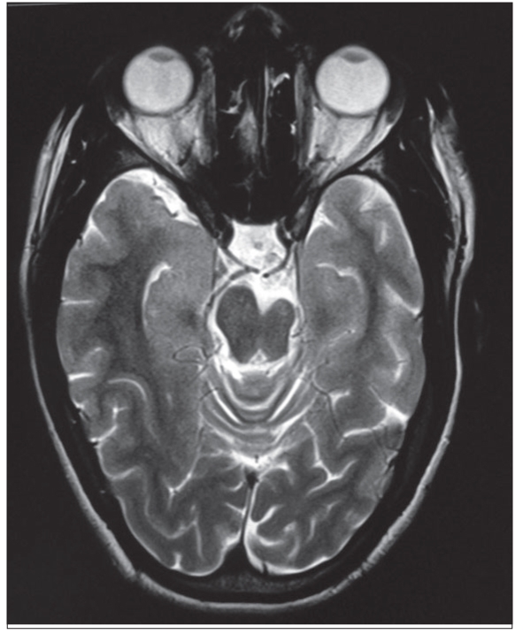 Figure 1B