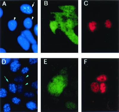 FIG. 11