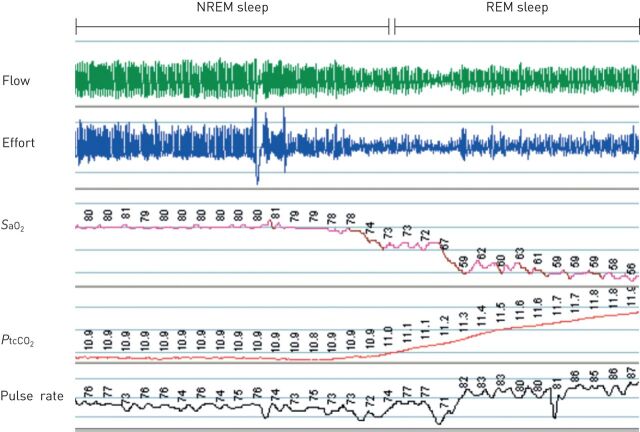 FIGURE 3