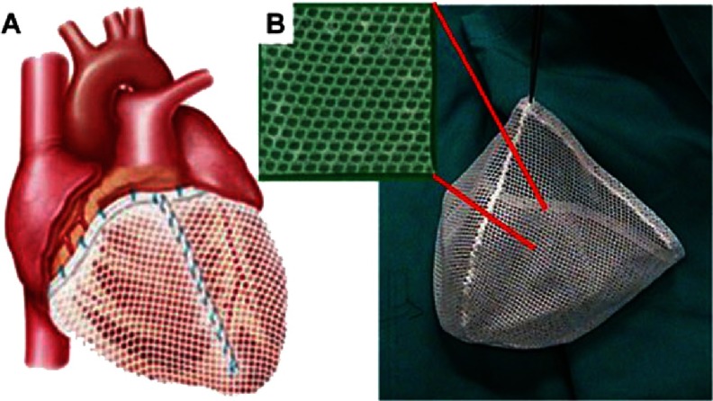 Figure 11.