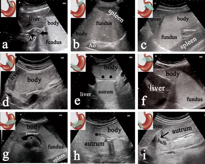 Fig. 2