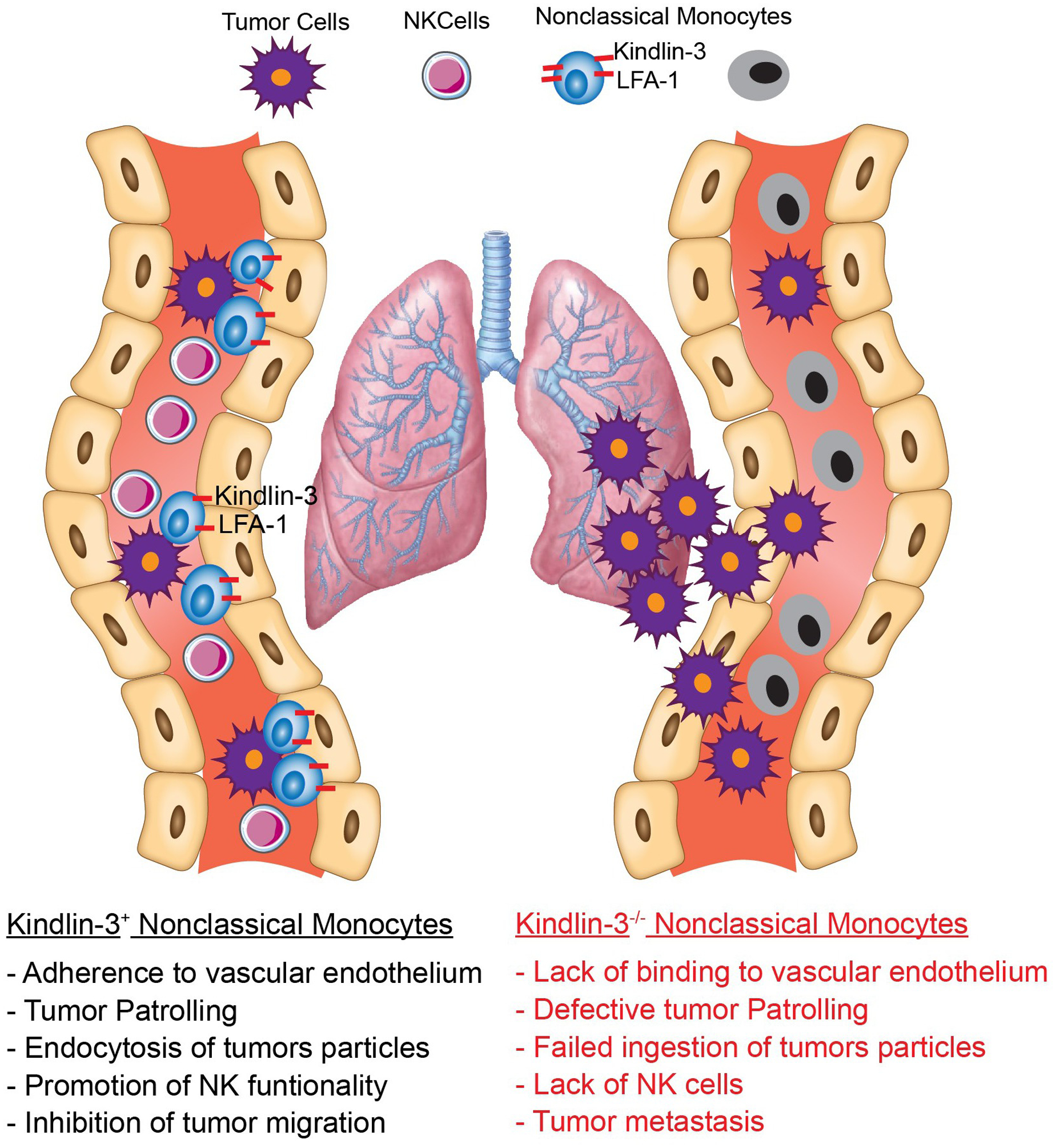 Expression of Kindlin-3 in Nonclassical Monocytes limits Cancer Cell Metastasis.