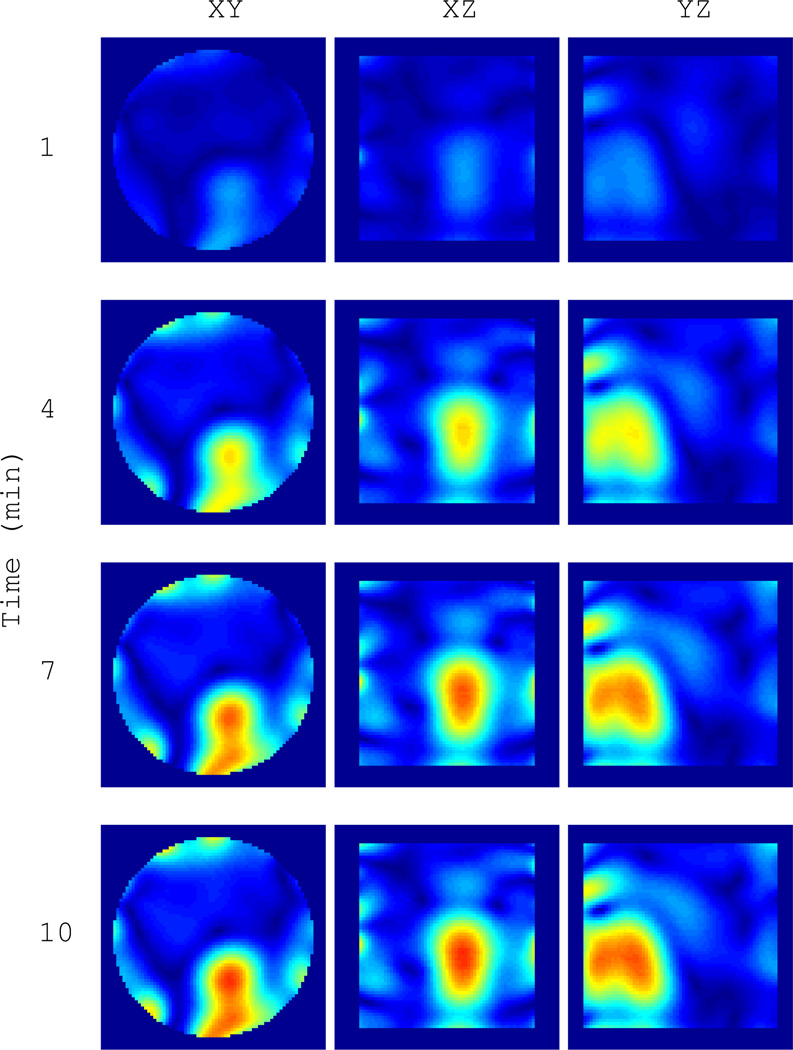 Fig. 13