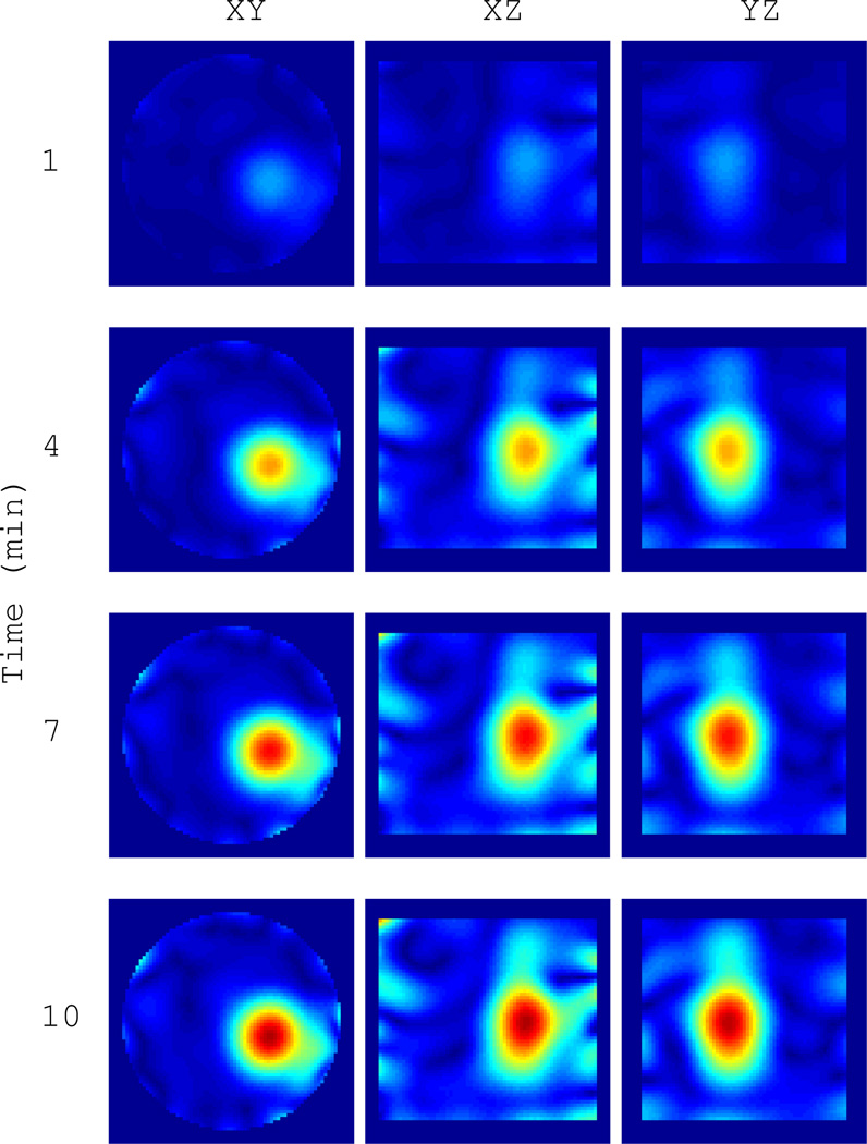 Fig. 11