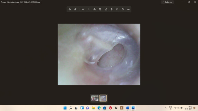 Fig. 2