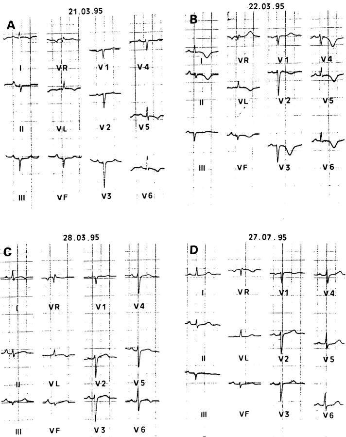 Figure 2  