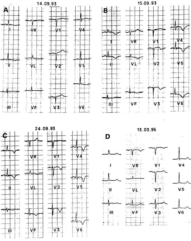 Figure 1  