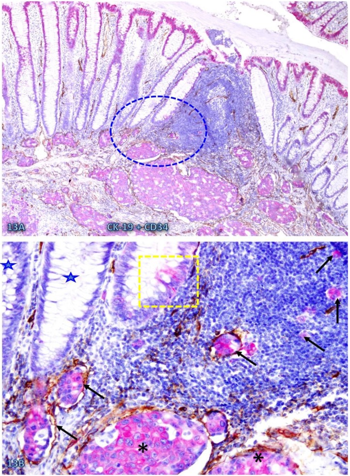 Fig 13