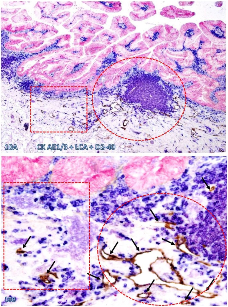 Fig 10