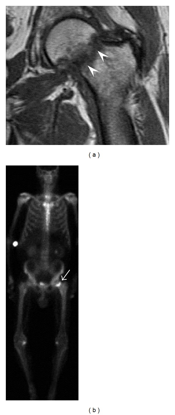 Figure 14