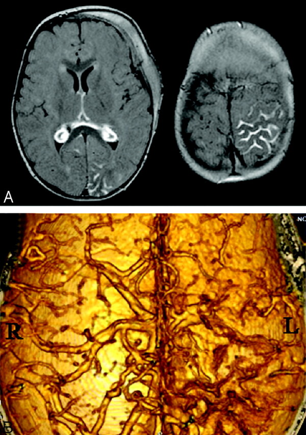 Fig 3.