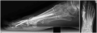 Figure 1 and 2.